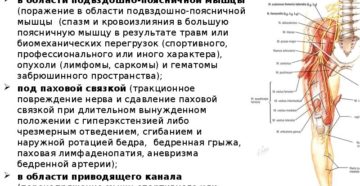 Синдром пояснично-подвздошной связки и миотонические синдромы при вертебролгиях