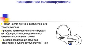 Доброкачественное пароксизмальное позиционное головокружение