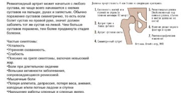 Симптомы ревматоидного артрита