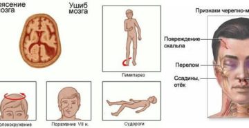 Травма головы,несвязная речь.