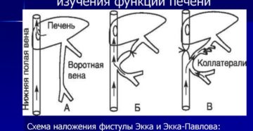 Специальные методы  исследования печени