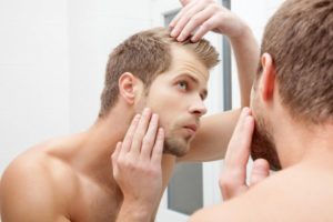 Мужчины и Потеря волос: Каковы Варианты?