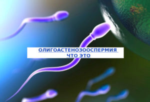 Олигоастенозооспермия