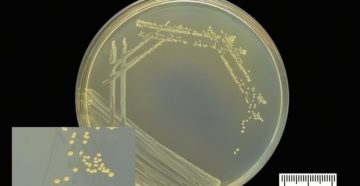 Enterococcus faecalis в моче у ребенка